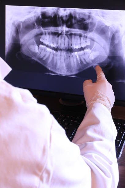 Best Emergency Tooth Extraction in Alhambra, CA