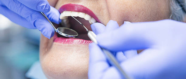 Best Emergency Tooth Extraction in Alhambra, CA